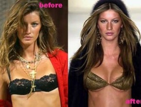 Gisele Bundchen before and after plastic surgery