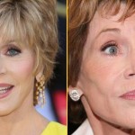 Jane Fonda before and after plastic surgery 03