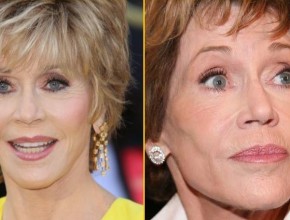 Jane Fonda before and after plastic surgery 03
