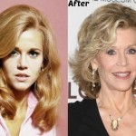 Jane Fonda before and after plastic surgery