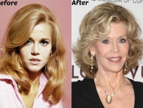 Jane Fonda before and after plastic surgery