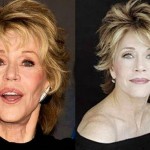 Jane Fonda before and after plastic surgery 05