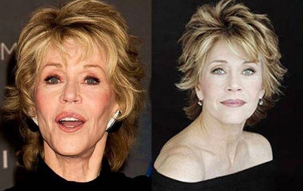 Jane Fonda Plastic Surgery Before After