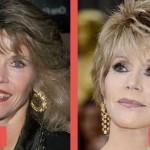 Jane Fonda before and after plastic surgery 06