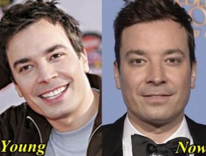 Jimmy Fallon before and after plastic surgery