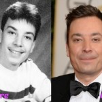 Jimmy Fallon before and after plastic surgery 04