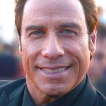John Travolta after plastic surgery using Botox injections