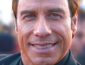 John Travolta after plastic surgery using Botox injections