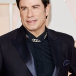 John Travolta after using Botox injections