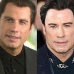 John Travolta before and after plastic surgery 02