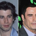 John Travolta before and after plastic surgery 03