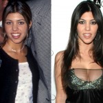 Kourtney Kardashian before and after breast augmentation 02