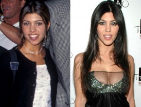 Kourtney Kardashian before and after breast augmentation 02