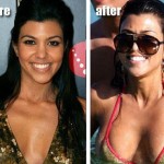 Kourtney Kardashian before and after plastic surgery 02