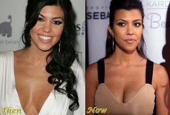 Kourtney Kardashian before and after plastic surgery