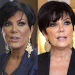Kris Jenner before and after plastic surgery 04