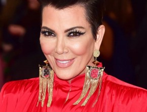 Kris Jenner plastic surgery 01