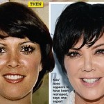 Kris Jenner then and now after plastic surgery