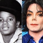 Michael Jackson before and after many plastic surgeries