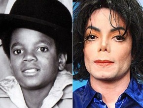 Michael Jackson before and after many plastic surgeries