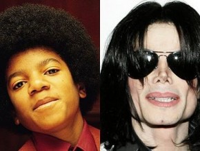 Michael Jackson before and after plastic surgery 02