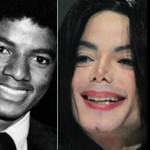 Michael Jackson before and after plastic surgery 03