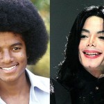 Michael Jackson before and after plastic surgery