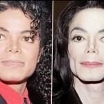 Michael Jackson before and after plastic surgery (2)