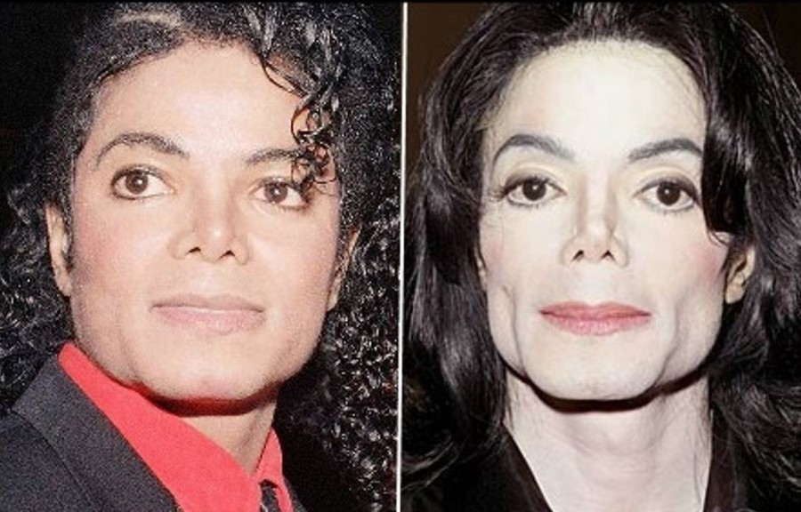 How Much Plastic Surgery Did Michael Jackson Have Unveiling The Truth How Much Plastic Surgery Did Michael Jackson Have Unveiling The Truth