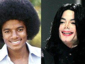 Michael Jackson before and after plastic surgery