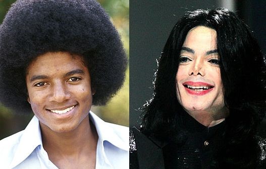 Michael Jackson before and after plastic surgery