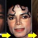 Michael Jackson cosmetic surgery disaster