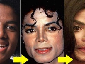 Michael Jackson cosmetic surgery disaster