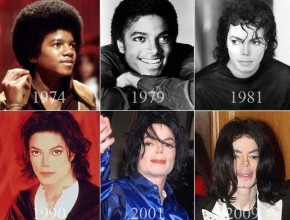 Michael Jackson from kid to plastic surgery disaster