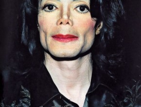 Michael Jackson plastic surgery disaster 02