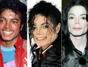 Michael Jackson plastic surgery transformations