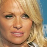 Pamela Anderson after botox injections