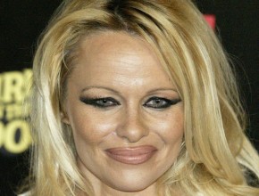 Pamela Anderson after eyelids and lips surgery