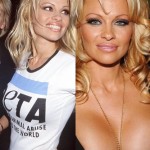 Pamela Anderson before and after breasts augmentation 03