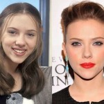 Scarlett Johansson before and after plastic surgery 03