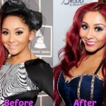 Snooki before and after breast augmentation