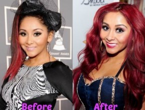 Snooki before and after breast augmentation