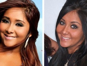 Snooki before and after nose job