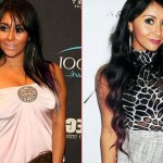 Snooki before and after plastic surgery 02