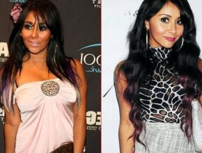 Snooki before and after plastic surgery 02