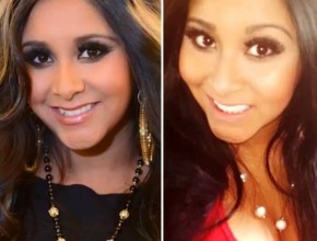 Snooki before and after plastic surgery