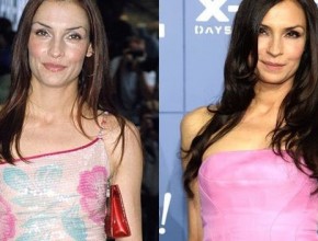 Famke Janssen before and after using botox injections