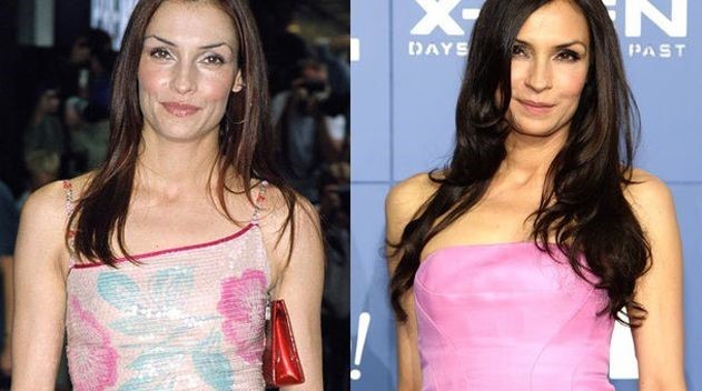 Famke Janssen before and afterusing botox injections