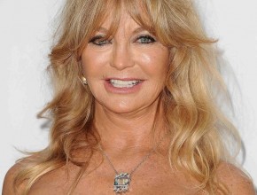 Goldie Hawn after plastic surgery 03