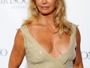 Goldie Hawn after plastic surgery